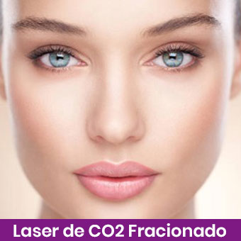 Laser-de-CO2-Fracionado